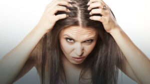 removes Dandruff